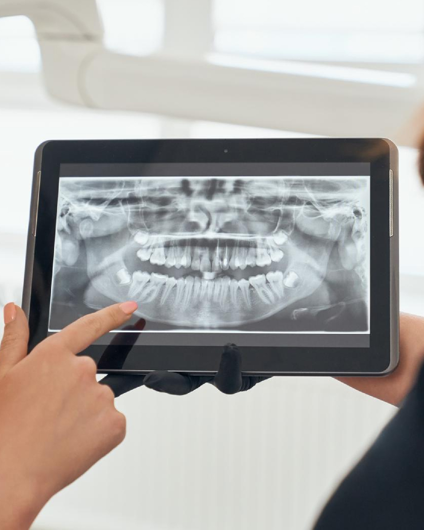 Second opinion with CBCT Scan