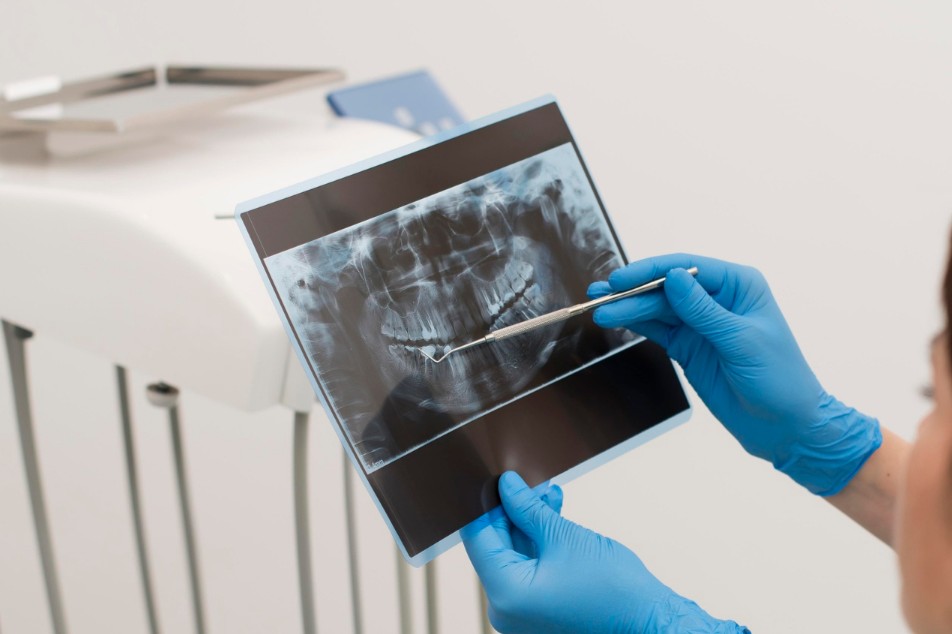 Dentist in gloves showing a patient their CBCT 3D dental scan at iCare Dental IOI City Mall Putrajaya