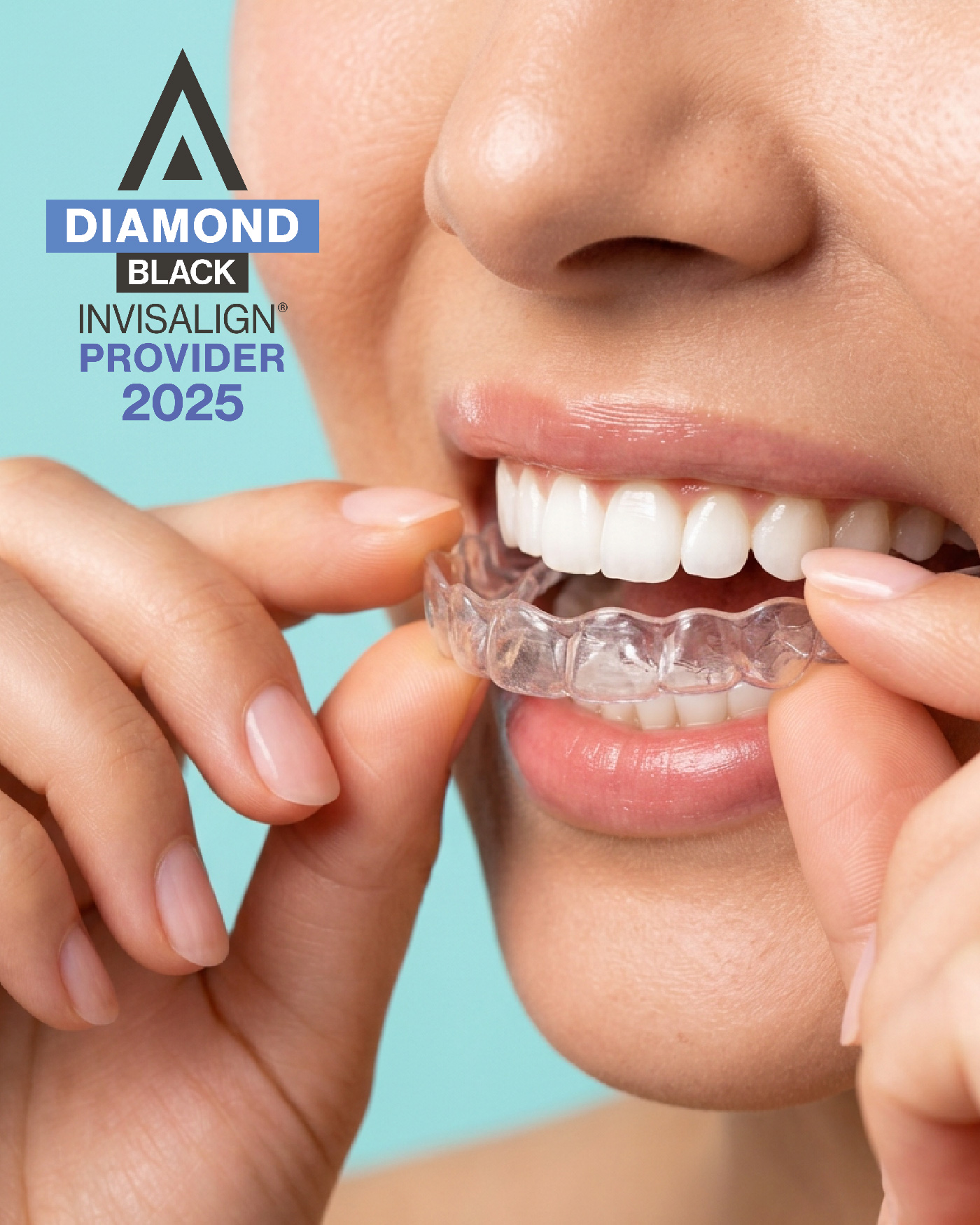 Invisalign