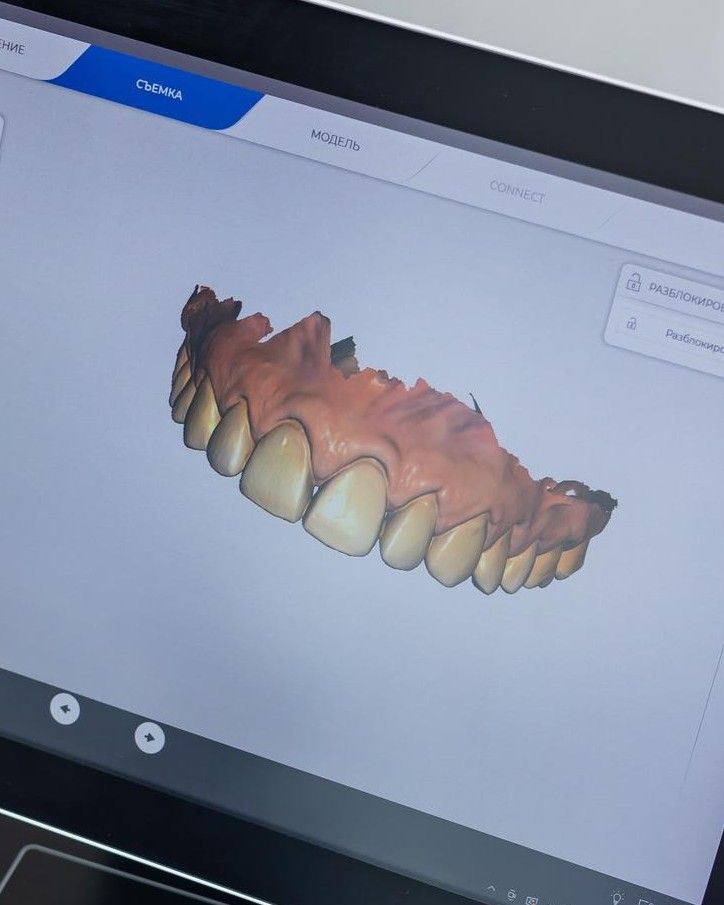 3D CBCT Scans