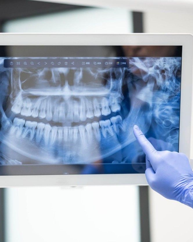Dentist pointing out a finding on a digital dental X-ray displayed on a monitor at iCare Dental IOI City Mall Putrajaya