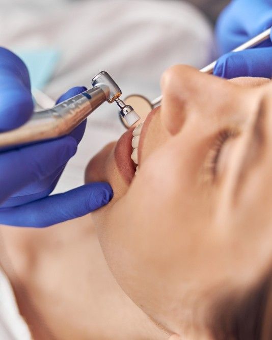 Dentist performing a routine scaling and polishing treatment on a patient at iCare Dental IOI City Mall Putrajaya