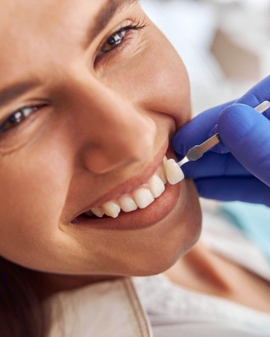 Close-up of a dentist checking a patient's tooth shade against her smile at iCare Dental IOI City Mall Putrajaya
