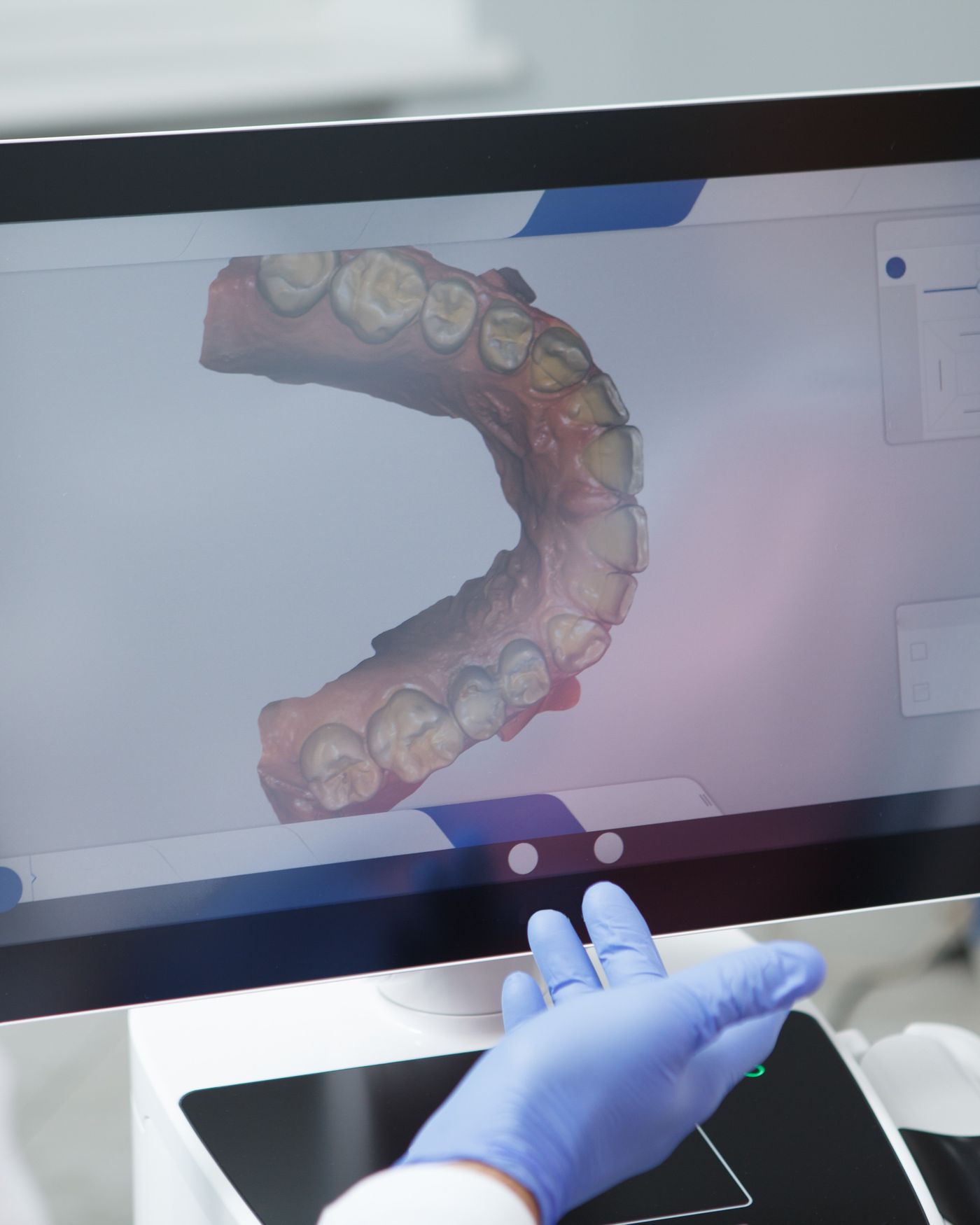 Close-up of a 3D dental scan displayed on screen at iCare Dental IOI City Mall Putrajaya
